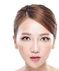 kinh ap trong mau trang